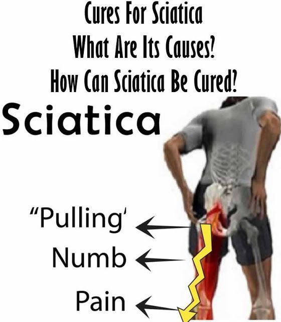 sciatica treatment sciatica exercises